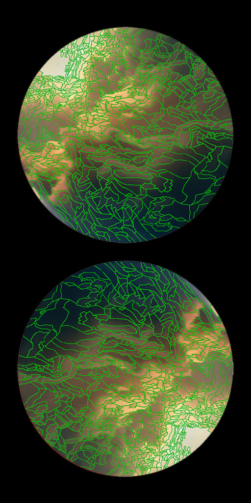 cloudtopography